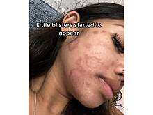 Девушка показала лицо после макияжа немытыми кистями