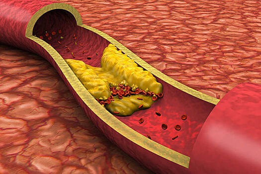 Как бездействие организма влияет на уровень холестерина