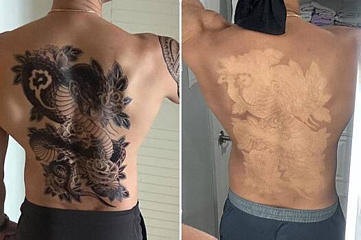 Мужчина снял временную татуировку после загара и удивил пользователей сети