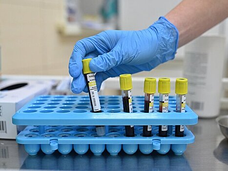 Терапевт Федосеева: объемный живот может возникнуть у стройных из-за цирроза печени