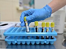 Терапевт Федосеева: объемный живот может возникнуть у стройных из-за цирроза печени