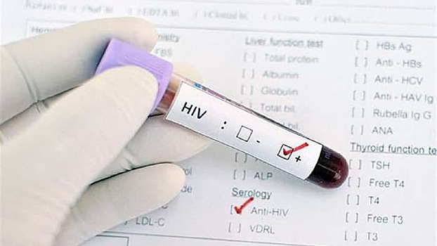 В Кургане горожане смогут бесплатно узнать свой ВИЧ-статус