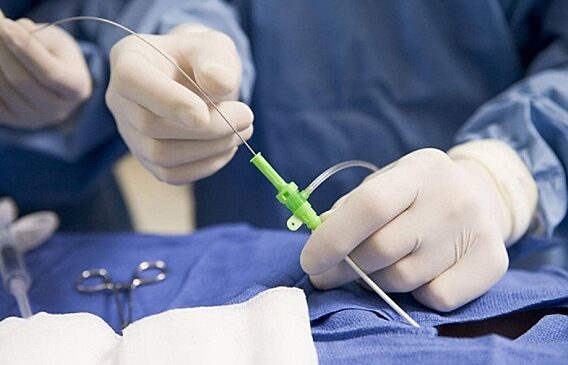 В Центре сосудистой хирургии Нягани проводят уникальные операции