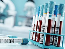 Общий анализ крови: какую информацию он дает