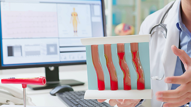 Можно ли почистить сосуды: отвечает кардиолог