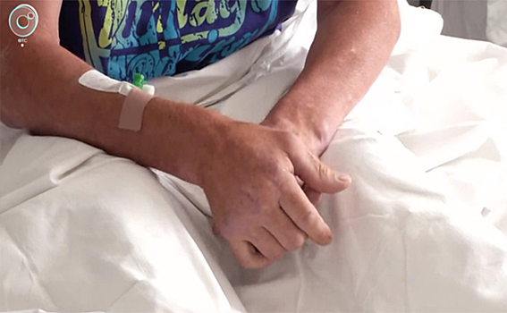 Пациенты с «летними» переломами заполнили травматологию