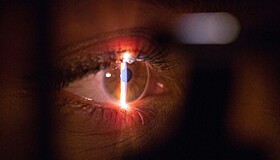 Ухудшение зрения может быть симптомом гипертонической болезни
