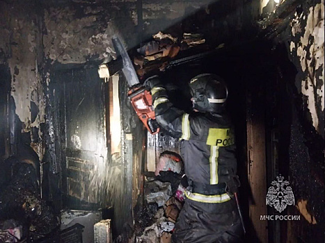 В Белогорске при пожаре в доме пострадали двое детей