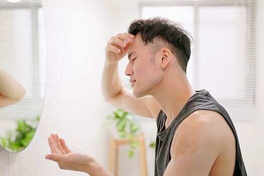 Эксперты раскрыли малоизвестную причину выпадения волос, которую можно заметить весной