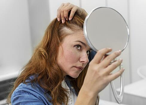 Эндокринолог Сидоркина: потеря волос может быть из-за стресса и плохого сна