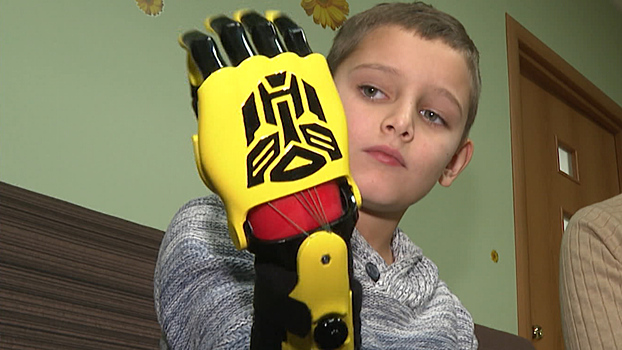 Дети из Калининграда бесплатно получат инновационные протезы из Сколково