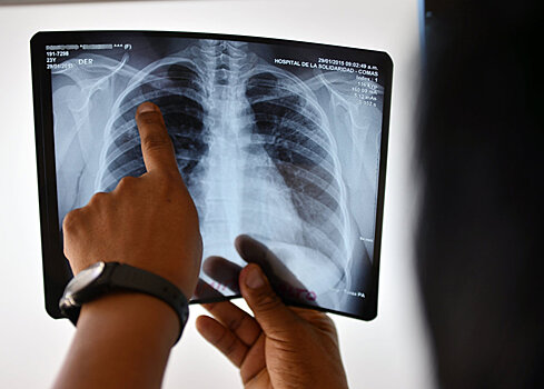 Почему некоторые нарынчане не лечатся от туберкулеза, рассказали в USAID