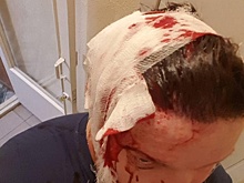 Помощник депутат гордумы, «пострадавший от неизвестных», побил себя сам