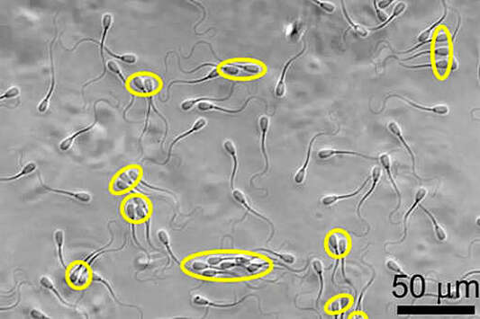 Сперматозоиды оказались способны сбиваться в стаи
