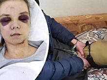 «Изнасилую и убью»: уралец избил свою девушку и попытался сжечь