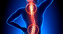 Развеян популярный миф о том, что нужно делать при болях в спине