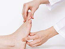 Медики выяснили, что плоскостопие не мешает бегунам