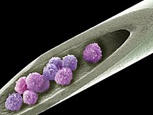 Применение стволовых клеток несет риск тромбоза
