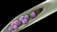 Применение стволовых клеток несет риск тромбоза