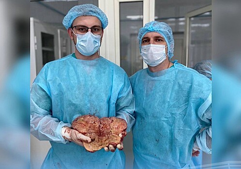 Оренбургские хирурги успешно удалили гигантскую опухоль у мужчины