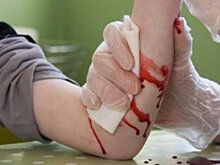 В технопарке «Строгино» разработали средство, позволяющее остановить сильное кровотечение за три минуты