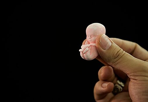 Женщинам предлагают потерпеть с абортом