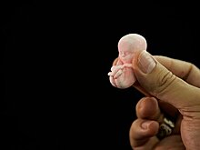 Женщинам предлагают потерпеть с абортом