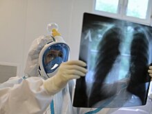 Распространенность туберкулеза в Москве за 10 лет снизилась почти в пять раз