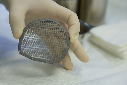 Во Владивостоке нейрохирурги использовали 3D-принтер для краниопластики