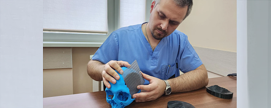Красногорский нейрохирург рассказал о создании имплантов с помощью 3D-моделирования