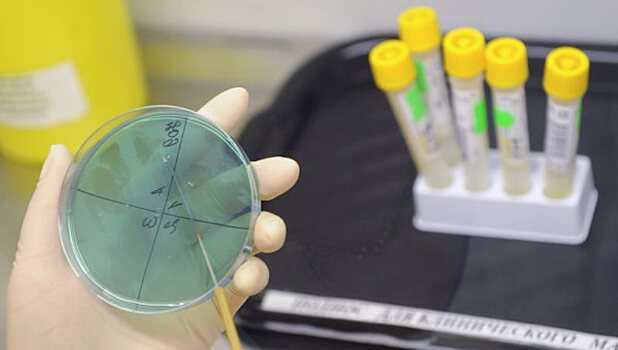 Химики  РФ научились диагностировать болезни почек с помощью подручных средств