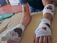 Ротвейлер напал на ассенизатора под Новосибирском