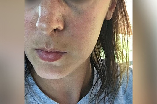 «Схватила за волосы и ударила коленом»: челябинка сломала нос соседке за замечание ребёнку