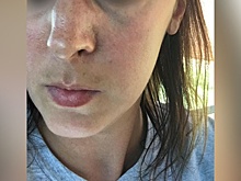 «Схватила за волосы и ударила коленом»: челябинка сломала нос соседке за замечание ребёнку