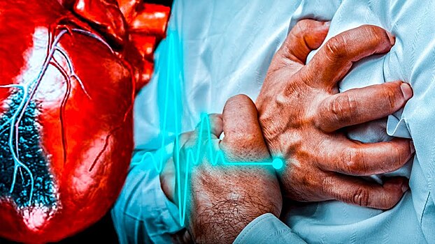 Более двух тысяч вологжан скончались от инфаркта миокарда и инсульта