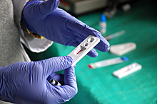 В России появились первые в мире тесты на ВИЧ, гепатит и сифилис