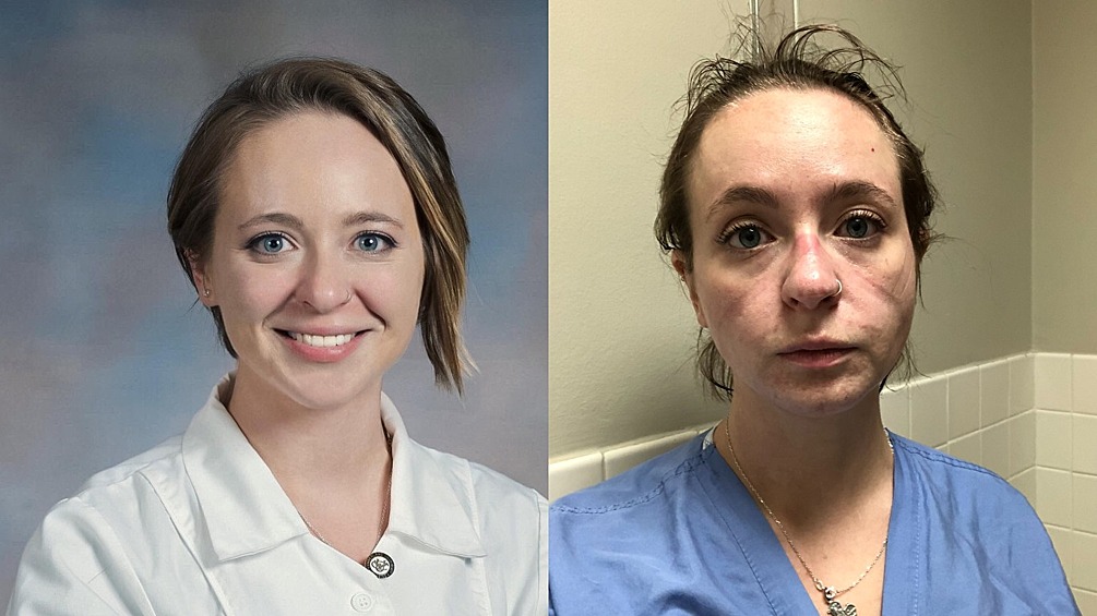 28-летняя медсестра из США Кэтрин работает в отделении интенсивной терапии. Недавно девушка опубликовала в Twitter фото себя, измученной пандемией коронавируса и запустила челлендж в Сети.