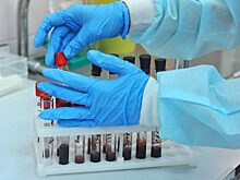 Ученые рассказали, что провоцирует развитие рака