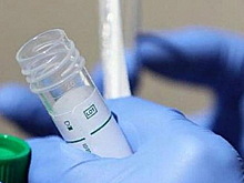 В Новосибирской области выявили 65 новых случаев коронавируса