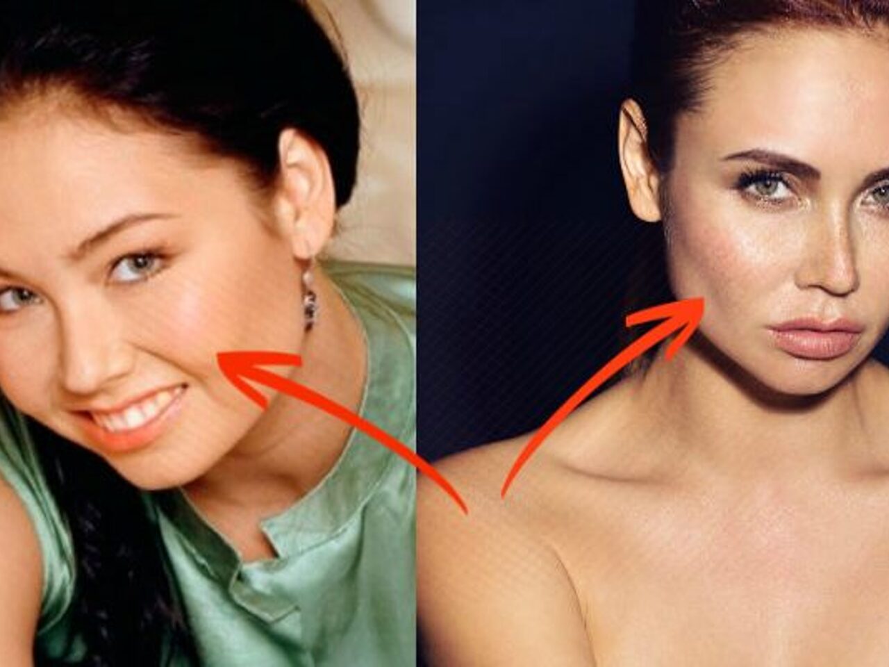 Ляйсан утяшева. Ляйсан утяшева. Утяшева до пластики. Утяшева операции. Ляйсан утяшева до пластики.