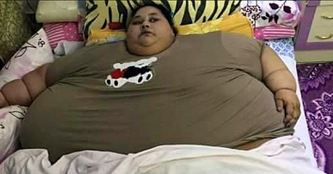 Самая тучная женщина планеты сбросила 140 кг