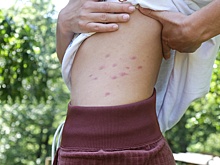 Как вывести блох в доме навсегда: лучшие способы и советы экспертов