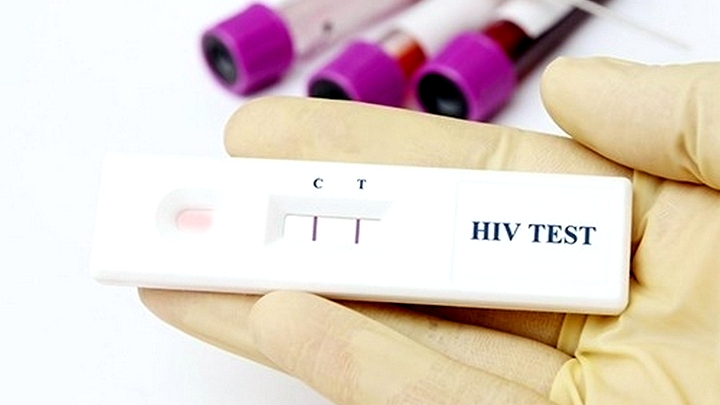 12 жителей Вологды узнали о положительном ВИЧ-статусе в апреле