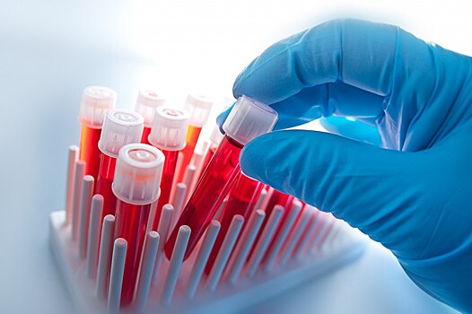 Учёные научились определять рак по капле крови