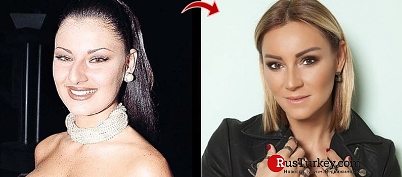 Как менялись носы популярных в России турецких актрис