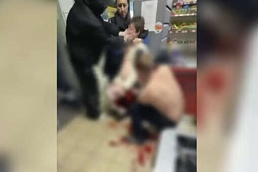 В Минусинске подростка ударили ножом во время драки