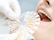 Стоматолог назвала продукты, влияющие на цвет зубов