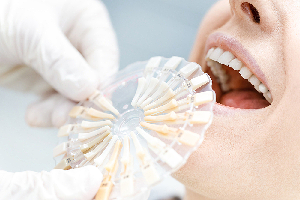 Стоматолог назвала продукты, влияющие на цвет зубов