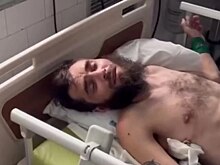 Российский турист на Бали сломал позвоночник, упав с большой высоты