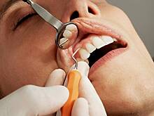 Стоматолог предупредил о причинах зубной боли в праздники